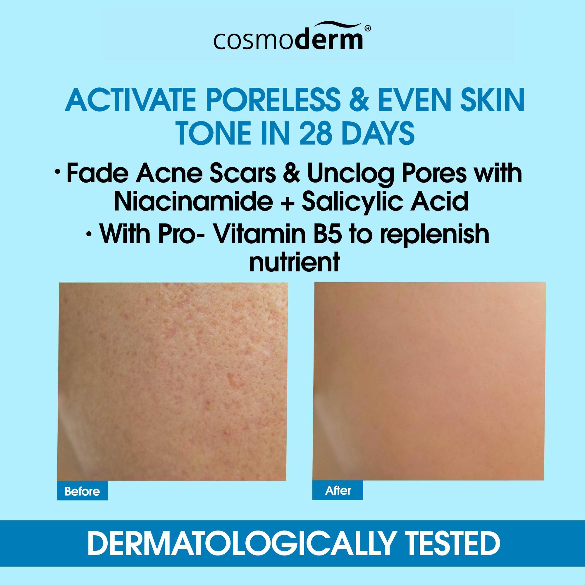 Cosmoderm Niacinamide Salicylic Acid Balancing GelCream Moisturiser 50ml